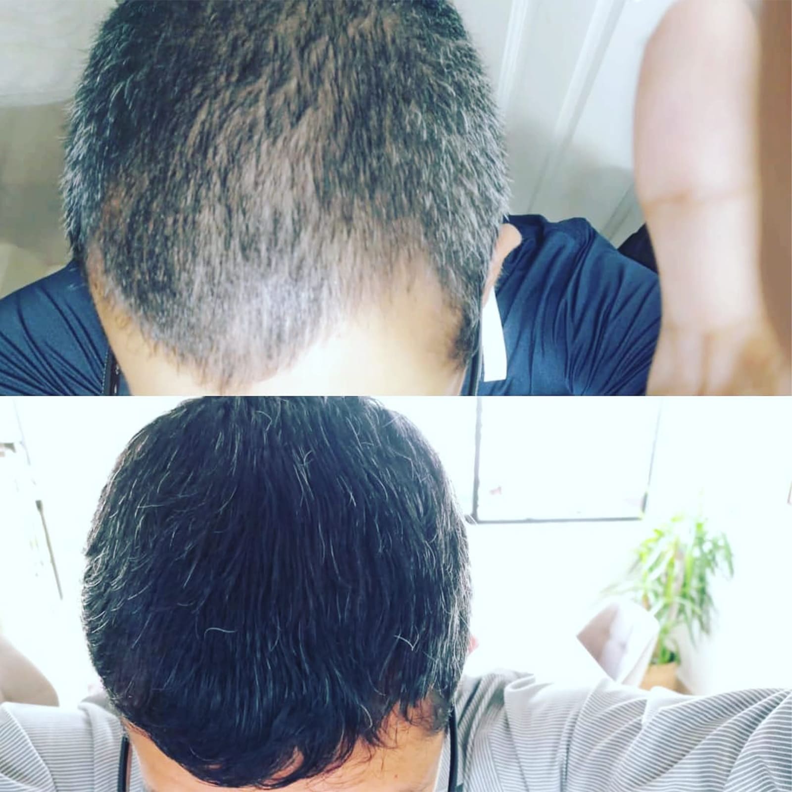 testimonio-de-tratamiendo-para-la-caida-del-cabello
